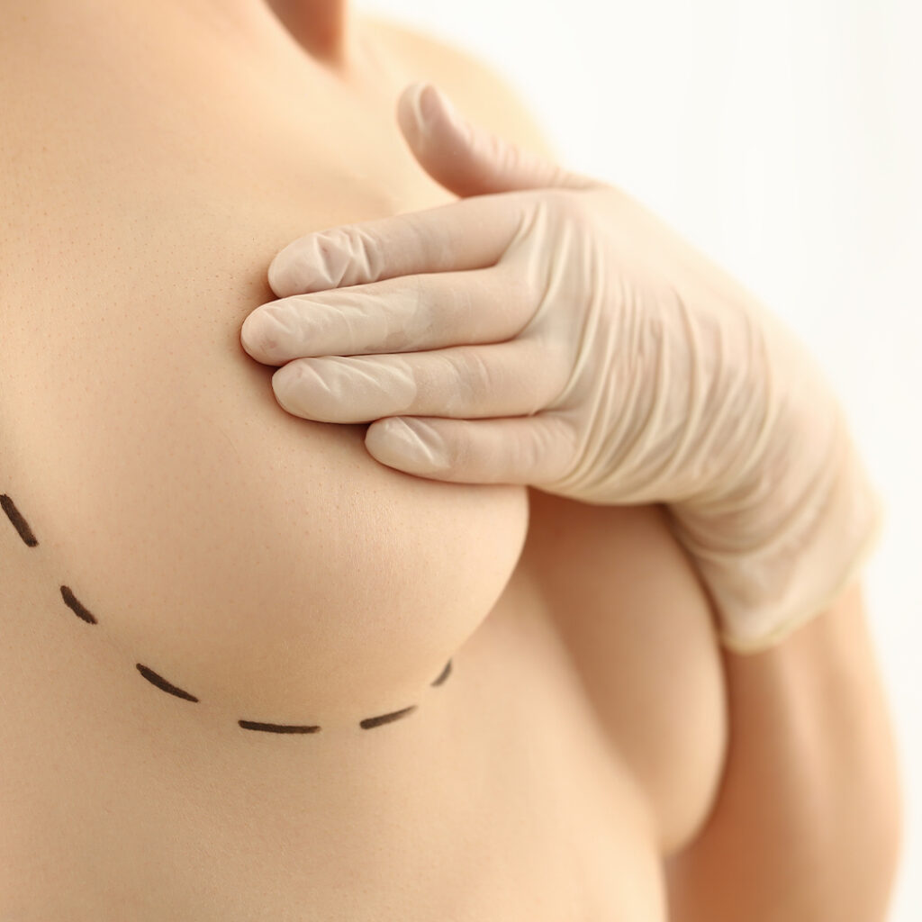Woman's breast with outline