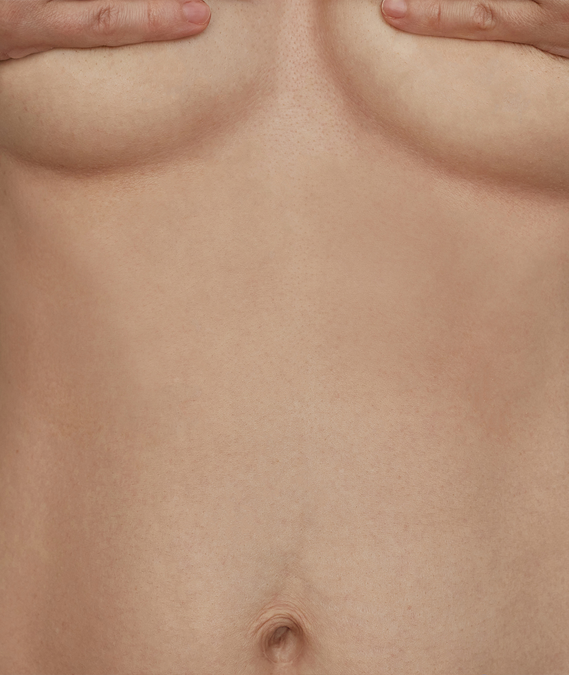 Photo of the bottom of a woman's breasts and stomach