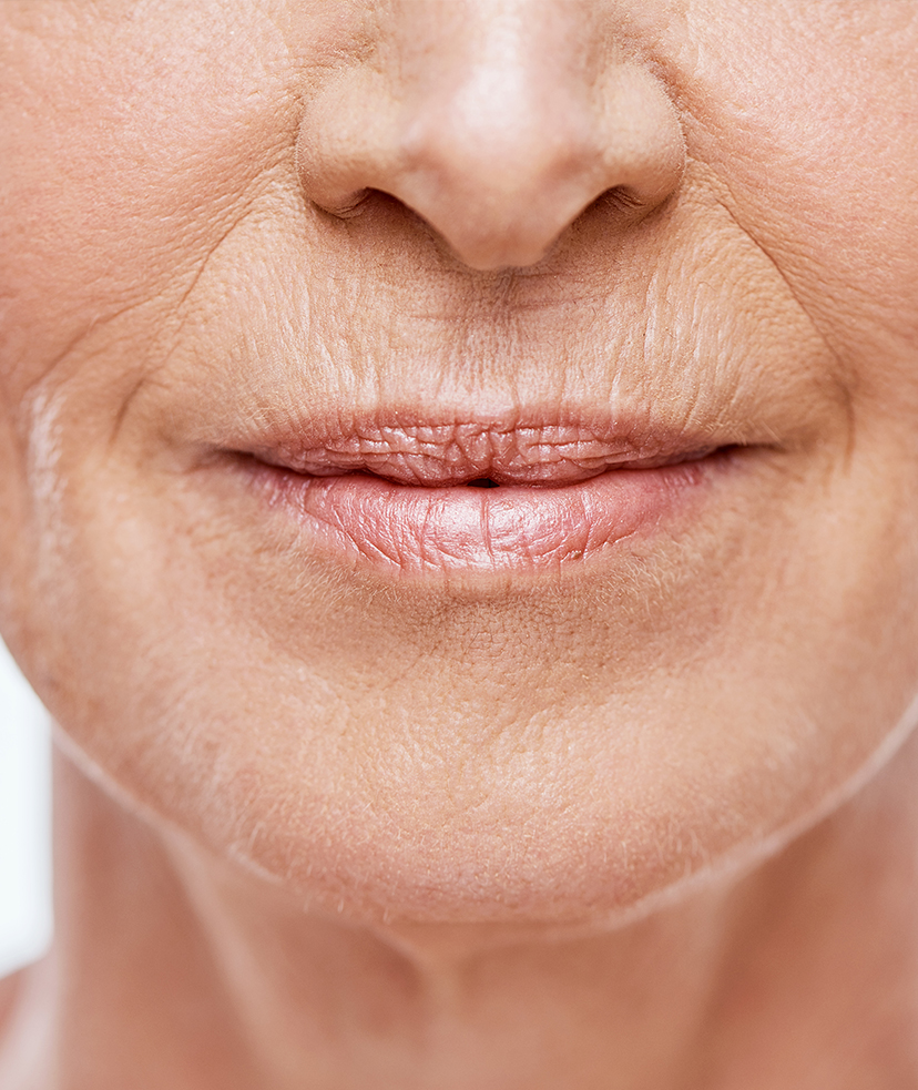 Close-up photo of facial wrinkles on a woman's lower face