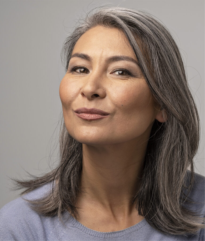 Photo of an Asian American woman with good facial volume