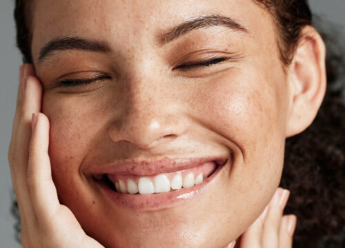 Photo of a smiling woman with good facial volume