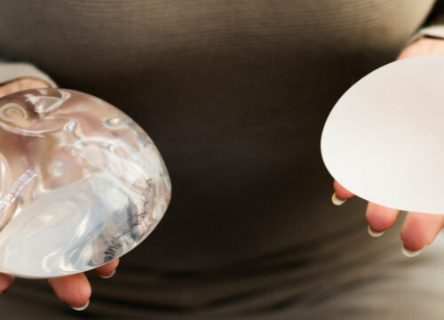 Photo of a woman holding two breast implants